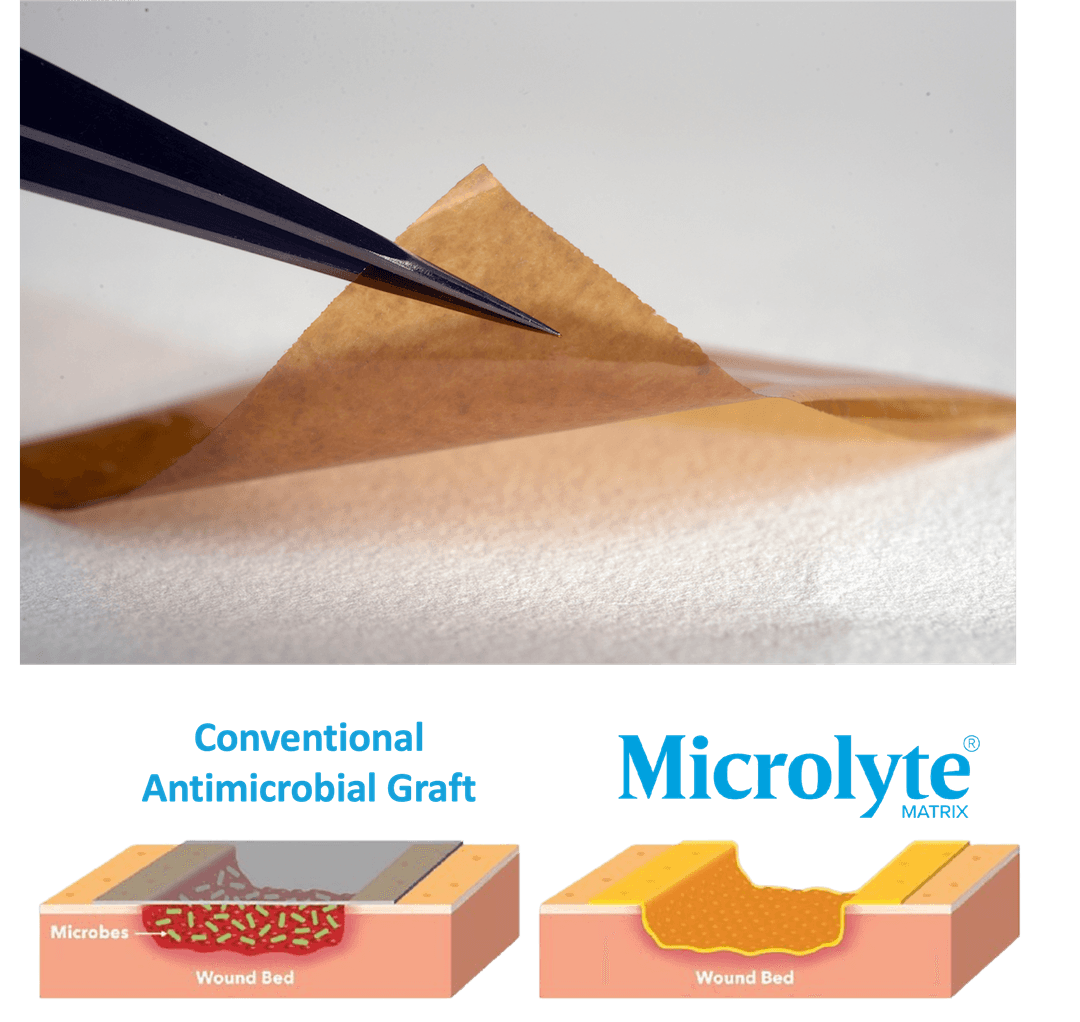 Microlyte Matrix Product